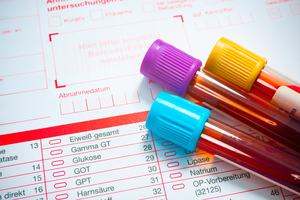 vials of blood lying on medical forms